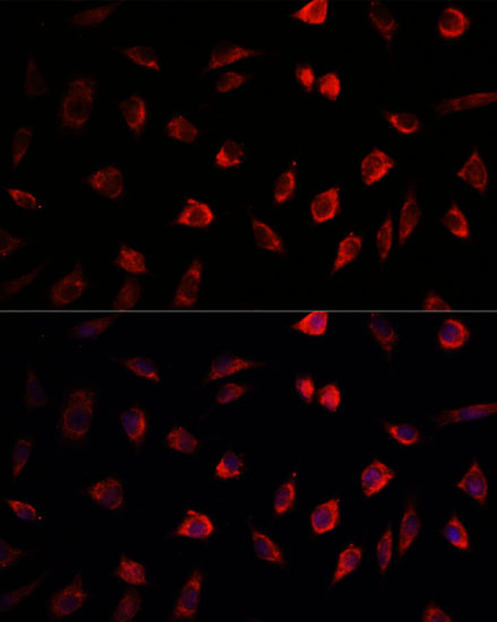 Immunofluorescence analysis of L929 cells using NEDD1 Polyclonal Antibody at dilution of  1:100. Blue: DAPI for nuclear staining.