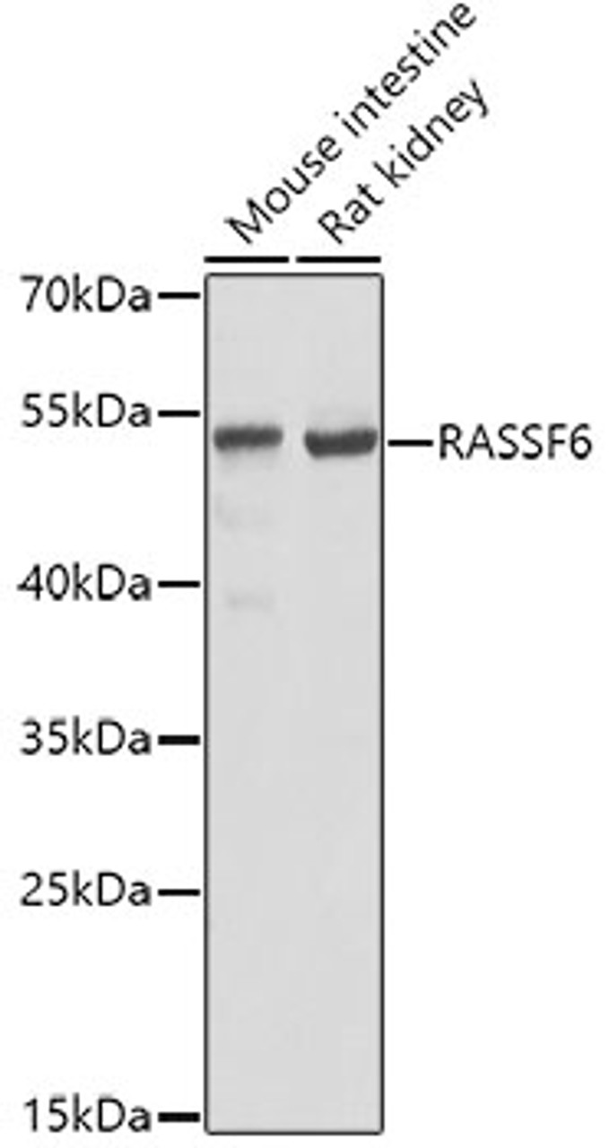 Western blot analysis of extracts of various cell lines using RASSF6 Polyclonal Antibody at dilution of 1:1000.