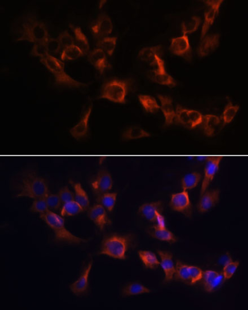 Immunofluorescence analysis of C6 cells using ARL13B Polyclonal Antibody at dilution of  1:100. Blue: DAPI for nuclear staining.
