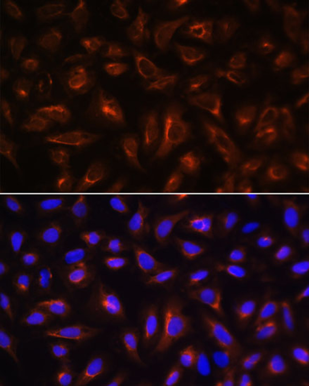 Immunofluorescence analysis of U-2 OS cells using ARL13B Polyclonal Antibody at dilution of  1:100. Blue: DAPI for nuclear staining.
