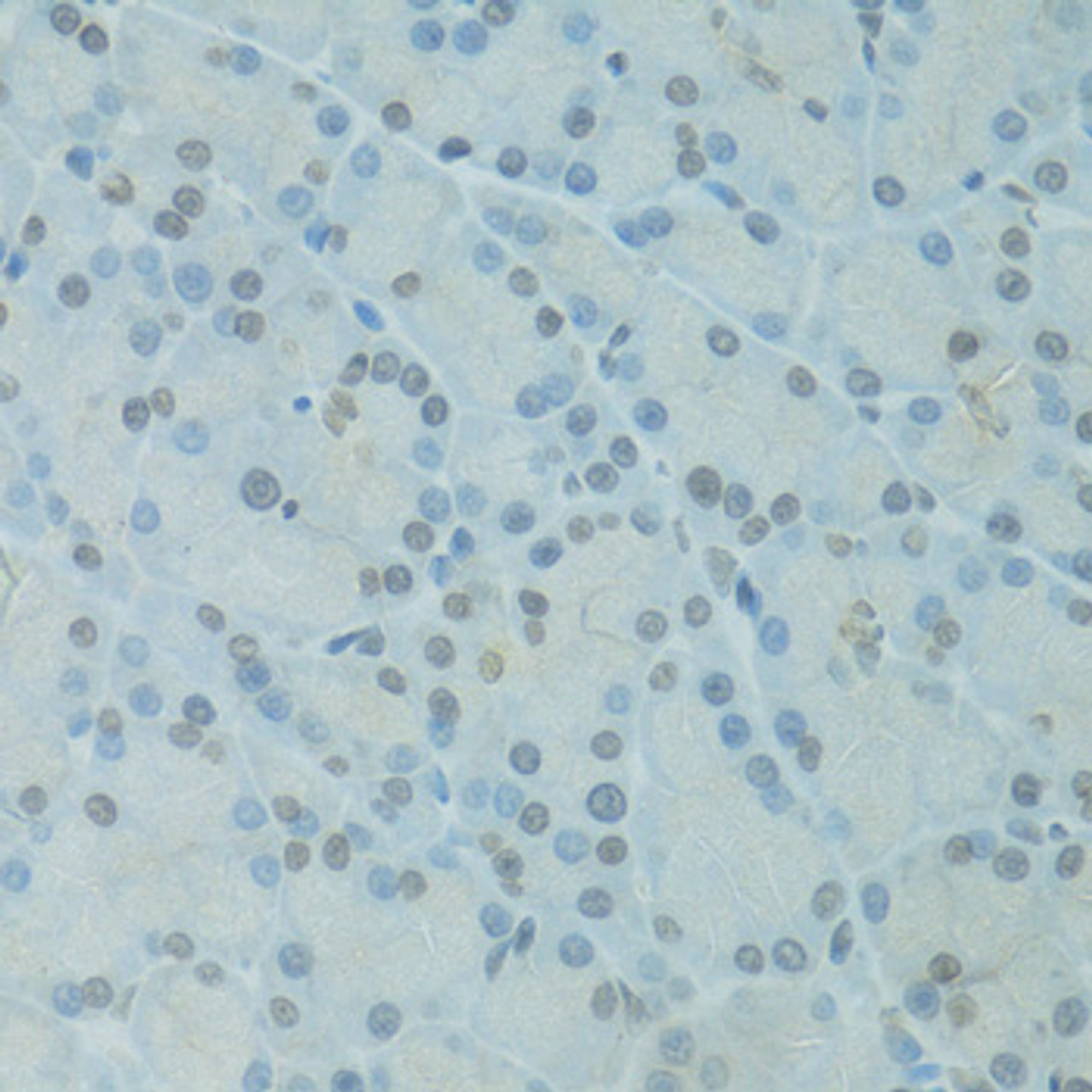 Immunohistochemistry of paraffin-embedded Rat pancreas using GTF2H2C Polyclonal Antibody at dilution of  1:100 (40x lens).