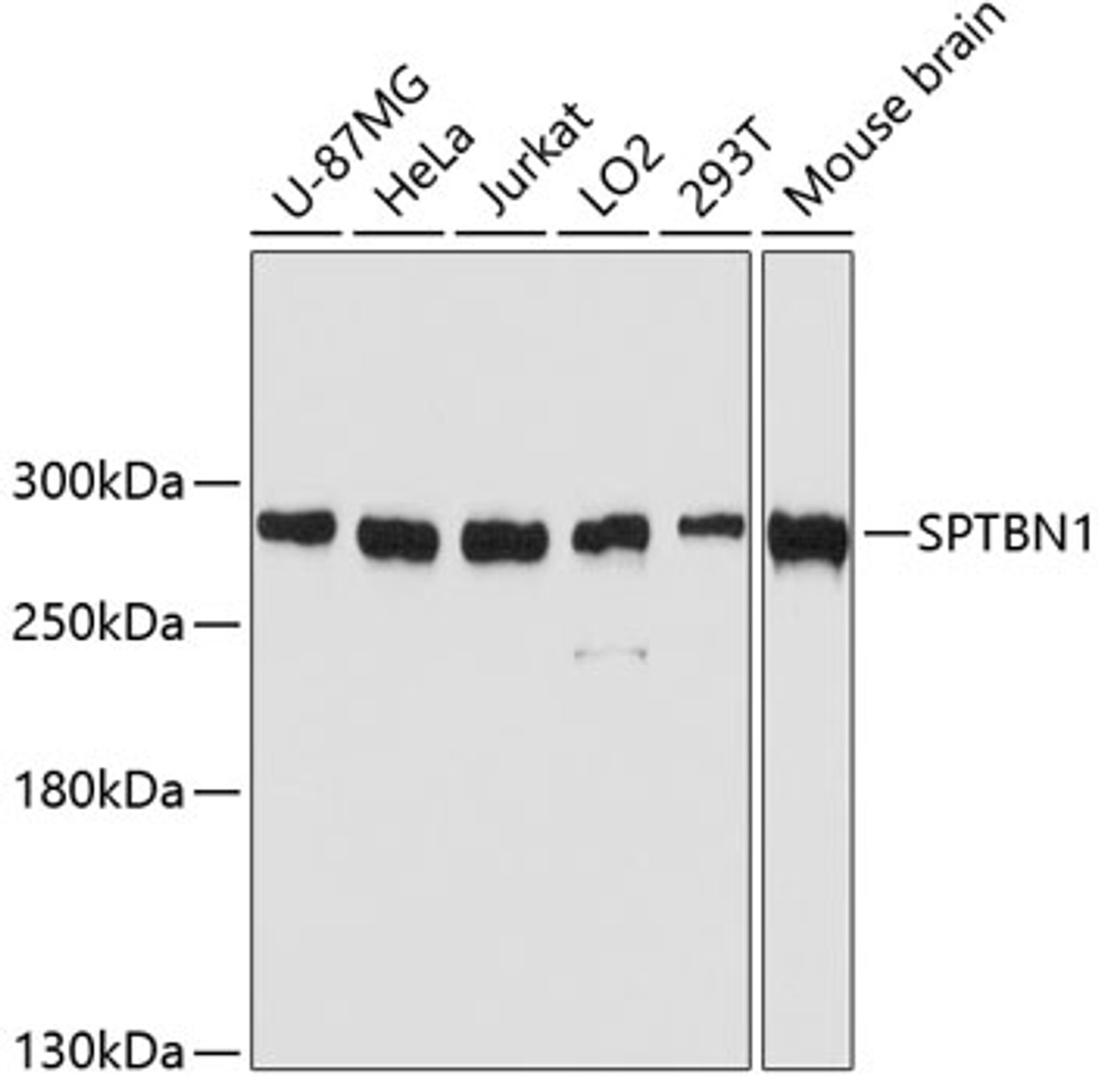 Western blot analysis of extracts of various cell lines using SPTBN1 Polyclonal Antibody at dilution of 1:3000.