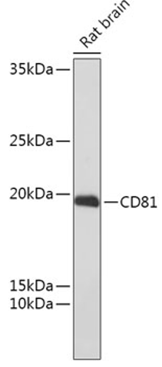 Western blot analysis of extracts of Rat brain using CD81 Polyclonal Antibody at dilution of 1:1000.