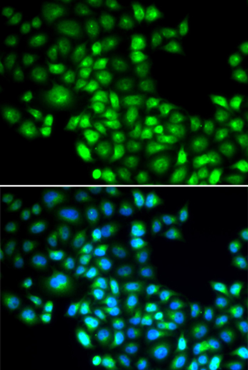 Immunofluorescence analysis of U2OS cells using FOXP1 Polyclonal Antibody