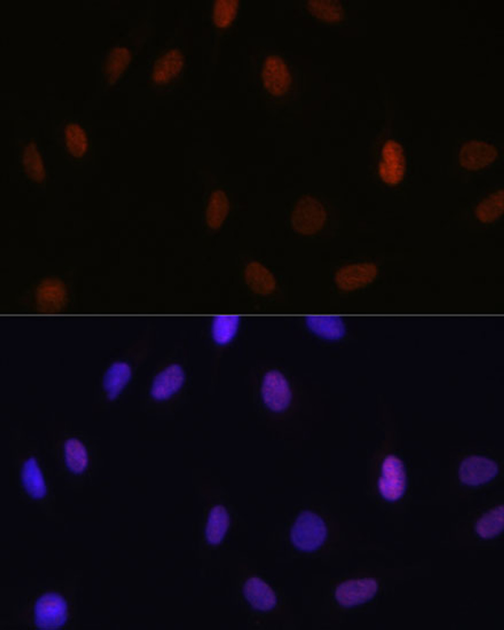 Immunofluorescence analysis of U-2 OS cells using MonoMethyl-Histone H3-K14 Polyclonal Antibody at dilution of  1:100 (40x lens). Blue: DAPI for nuclear staining.