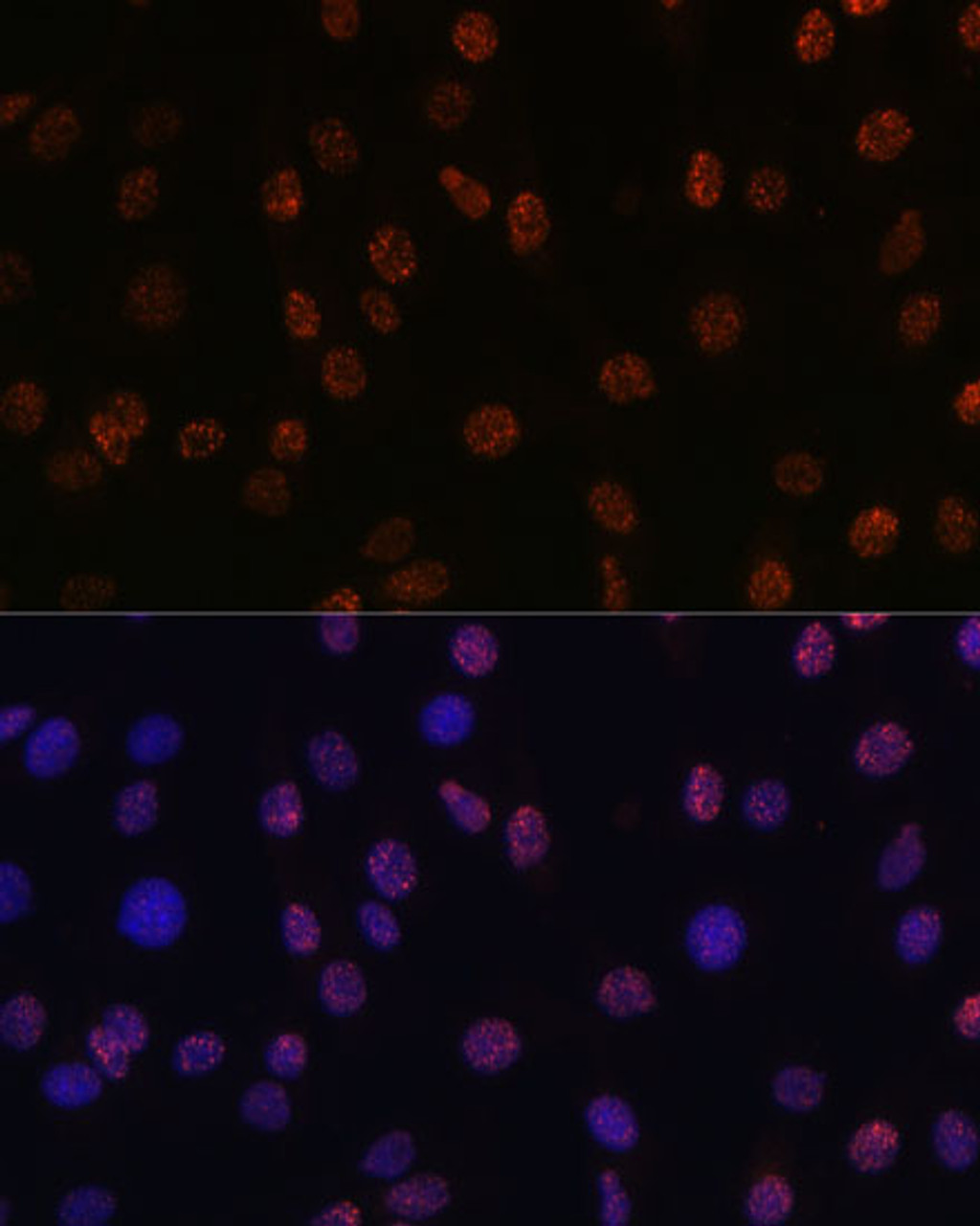 Immunofluorescence analysis of C6 cells using DiMethyl-Histone H3-K14 Polyclonal Antibody at dilution of  1:100 (40x lens). Blue: DAPI for nuclear staining.