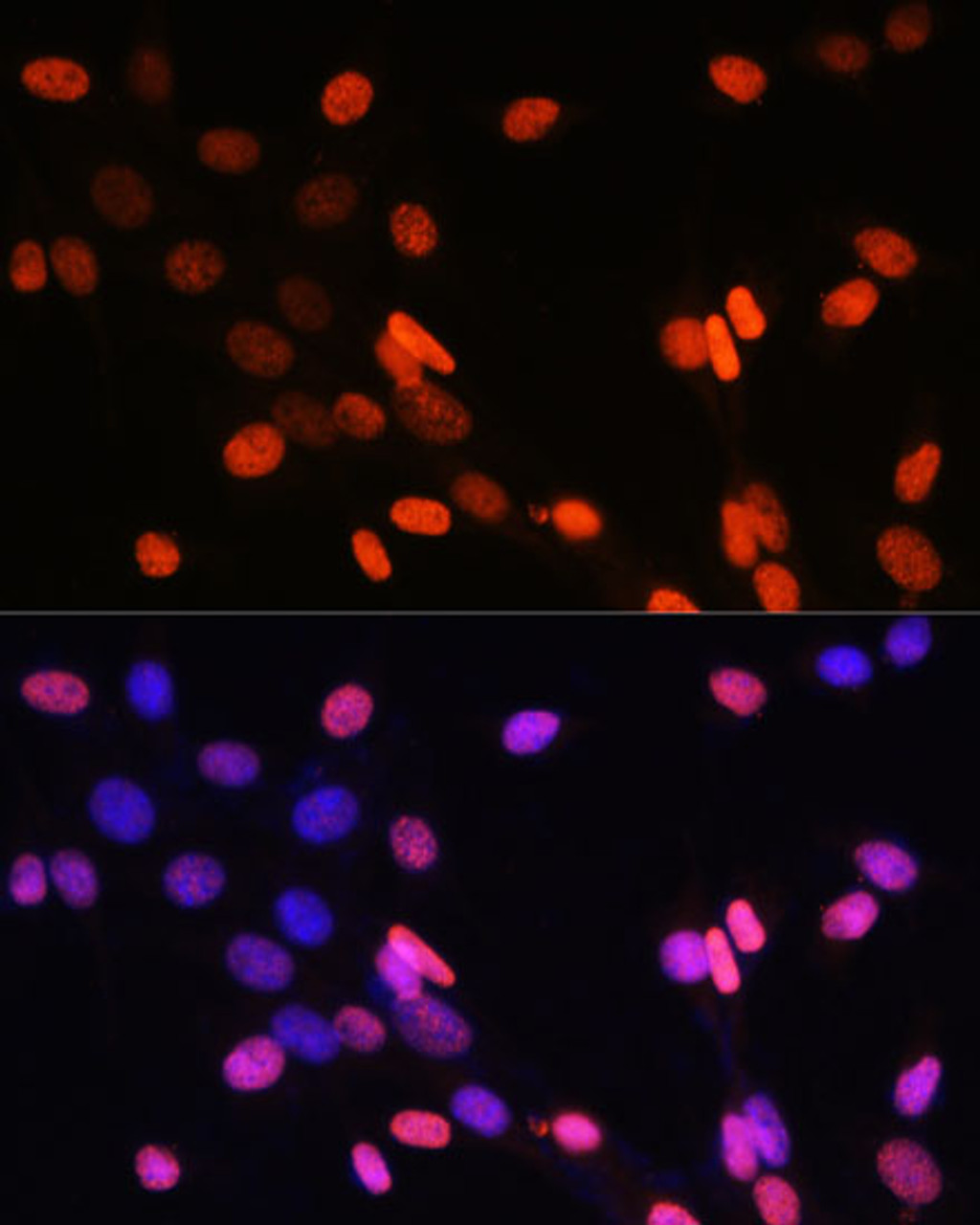 Immunofluorescence analysis of NIH-3T3 cells using DiMethyl-Histone H3-K14 Polyclonal Antibody at dilution of  1:100 (40x lens). Blue: DAPI for nuclear staining.