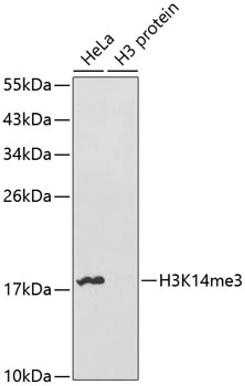 Western blot analysis of extracts of various cell lines using TriMethyl-Histone H3-K14 Polyclonal Antibody.