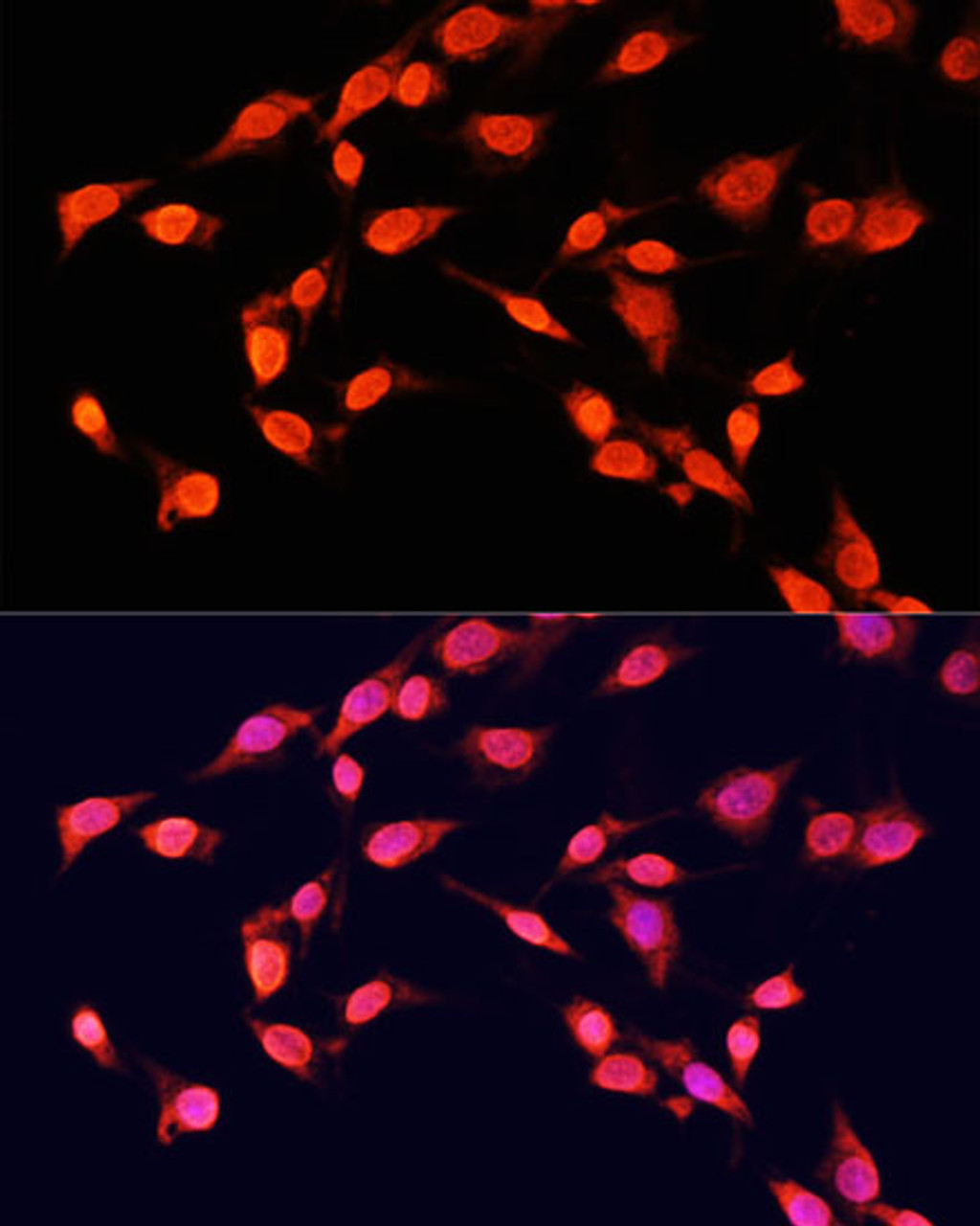 Immunofluorescence analysis of C6 cells using TriMethyl-Histone H3-K14 Polyclonal Antibody at dilution of  1:100 (40x lens). Blue: DAPI for nuclear staining.
