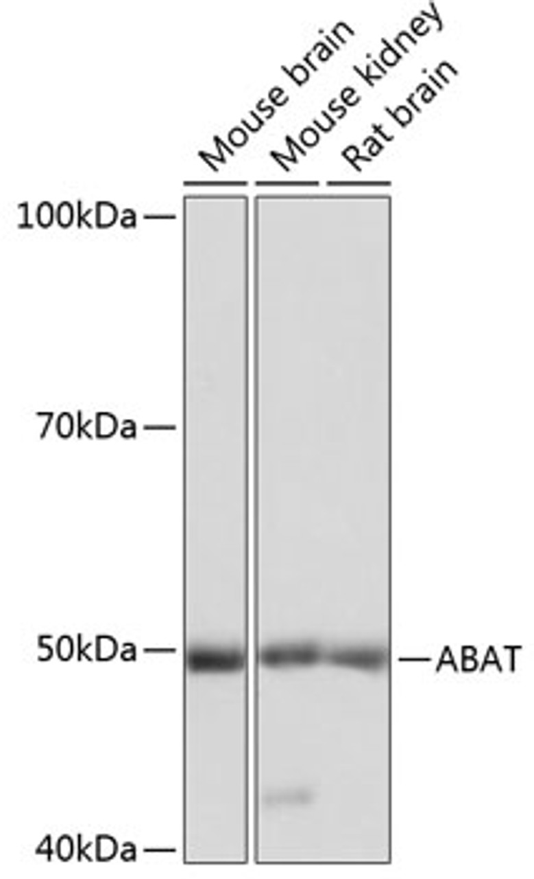 Western blot analysis of extracts of various cell lines using ABAT Polyclonal Antibody at dilution of 1:1000.