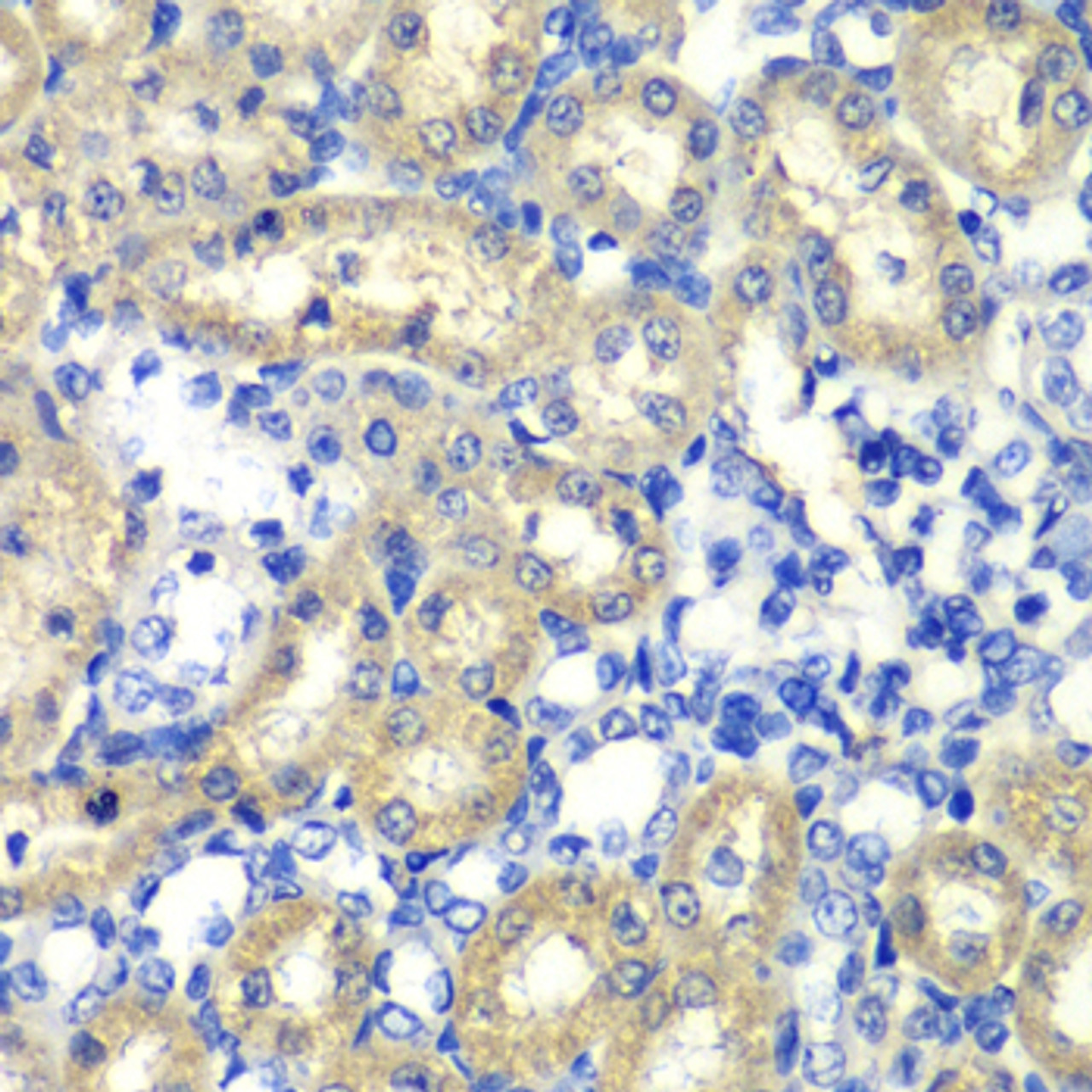 Immunohistochemistry of paraffin-embedded Rat kidney using ABAT Polyclonal Antibody at dilution of  1:100 (40x lens).