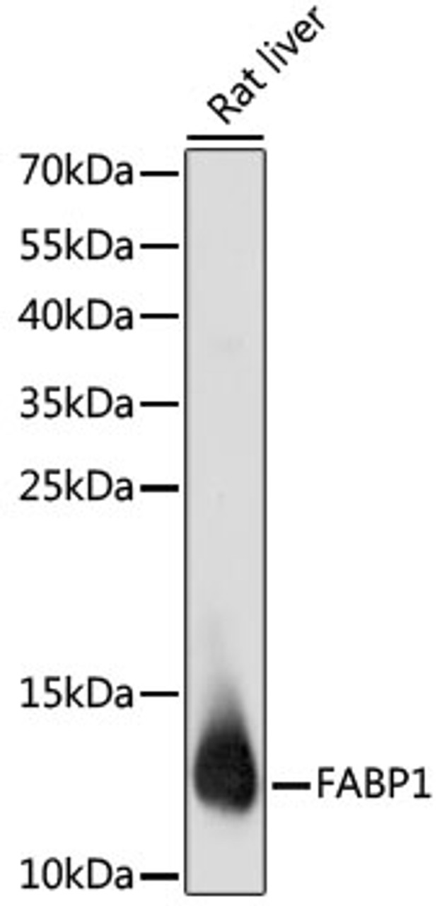 Western blot analysis of extracts of Rat liver using FABP1 Polyclonal Antibody at dilution of 1:1000.