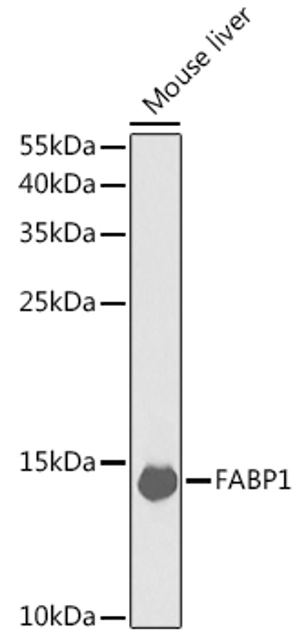 Western blot analysis of extracts of Mouse liver using FABP1 Polyclonal Antibody at dilution of 1:1000.