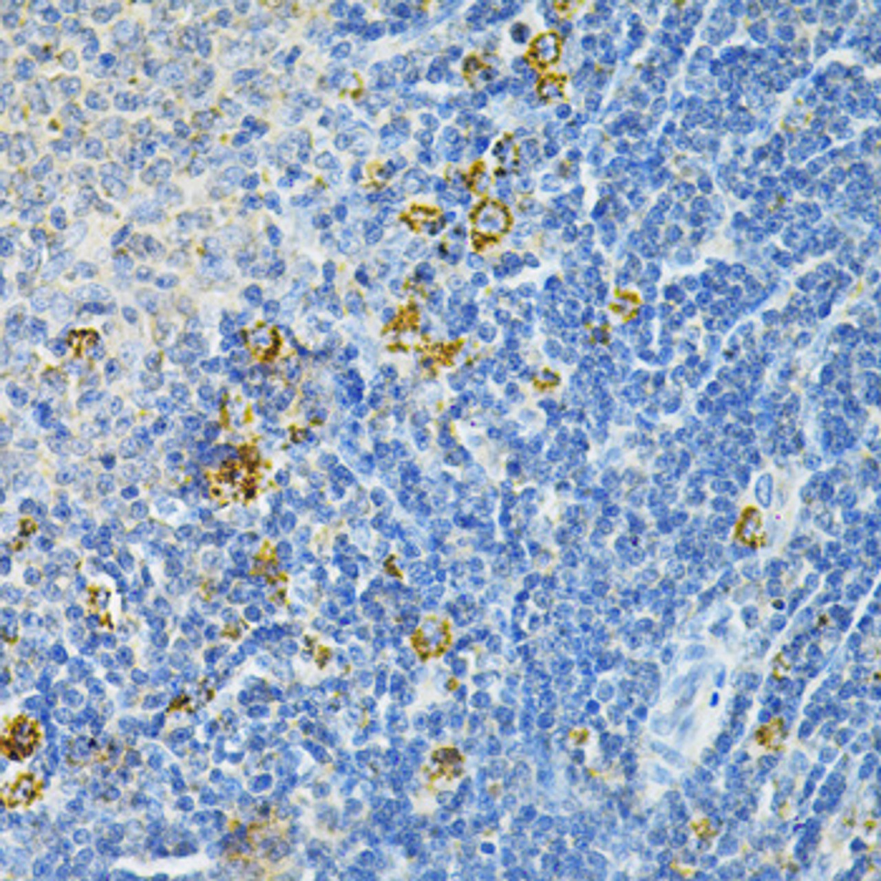 Immunohistochemistry of paraffin-embedded Rat spleen using GLRX Polyclonal Antibody at dilution of  1:200 (40x lens).