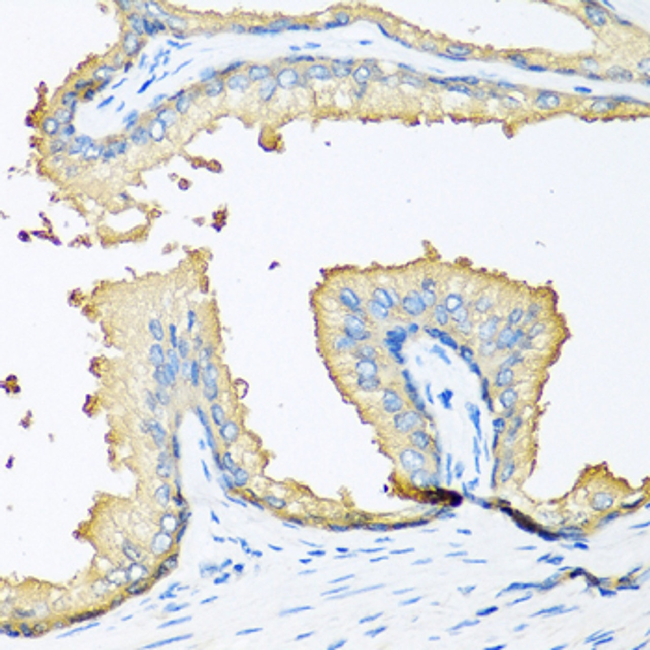 Immunohistochemistry of paraffin-embedded Human prostate using NOV Polyclonal Antibody at dilution of  1:100 (40x lens).