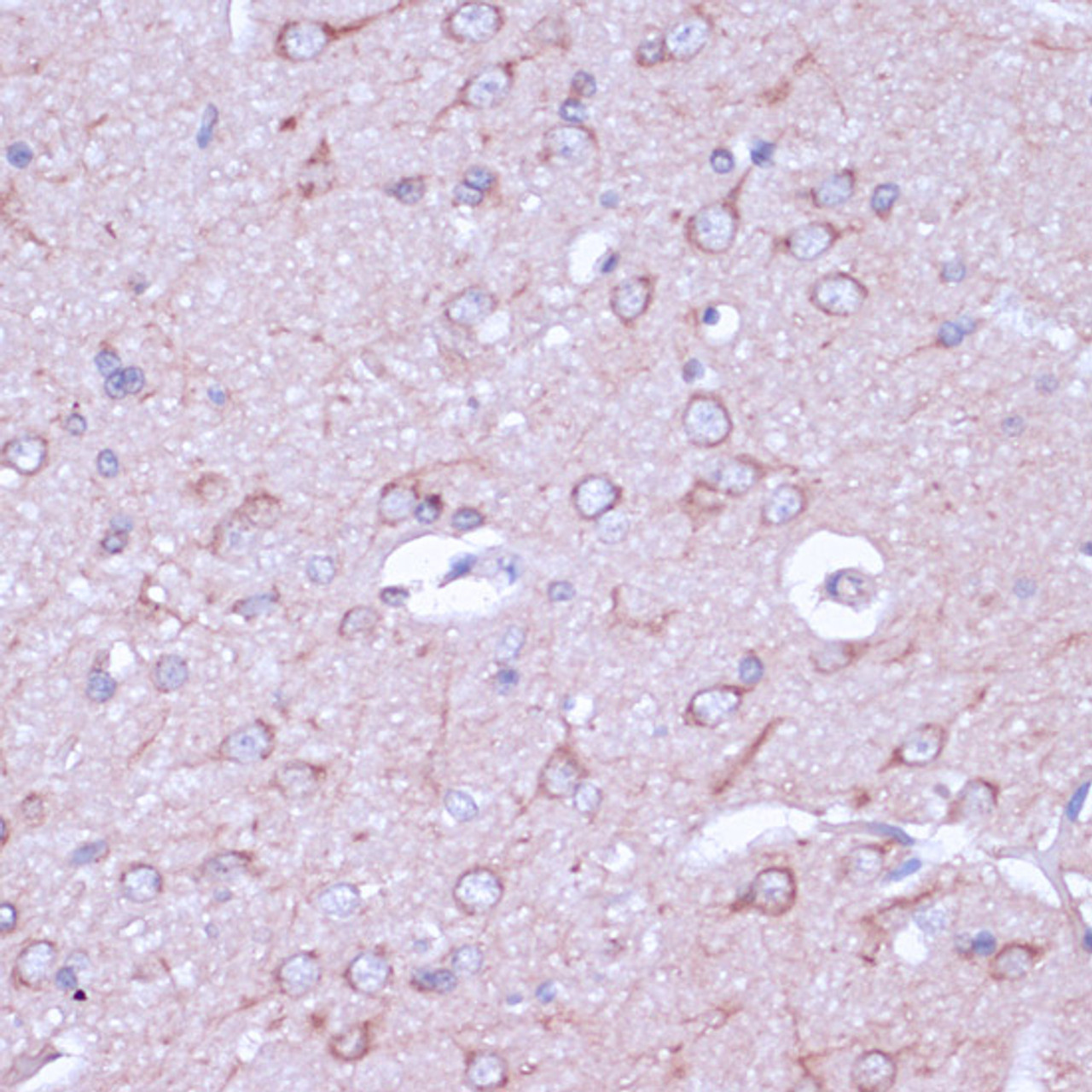 Immunohistochemistry of paraffin-embedded Rat brain using PRKACB Polyclonal Antibody at dilution of  1:100 (40x lens).