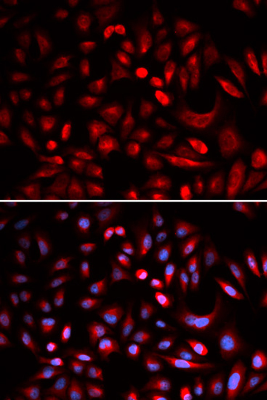 Immunofluorescence analysis of U2OS cells using PRKACB Polyclonal Antibody