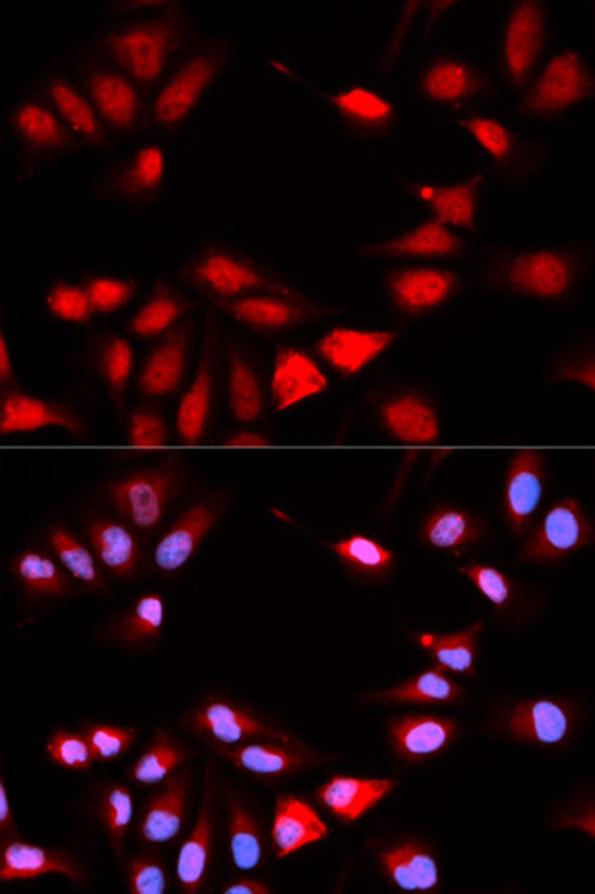 Immunofluorescence analysis of U2OS cells using RCAN1 Polyclonal Antibody