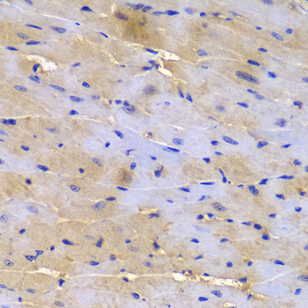 Immunohistochemistry of paraffin-embedded Mouse heart using SGCE Polyclonal Antibody at dilution of  1:200 (40x lens).