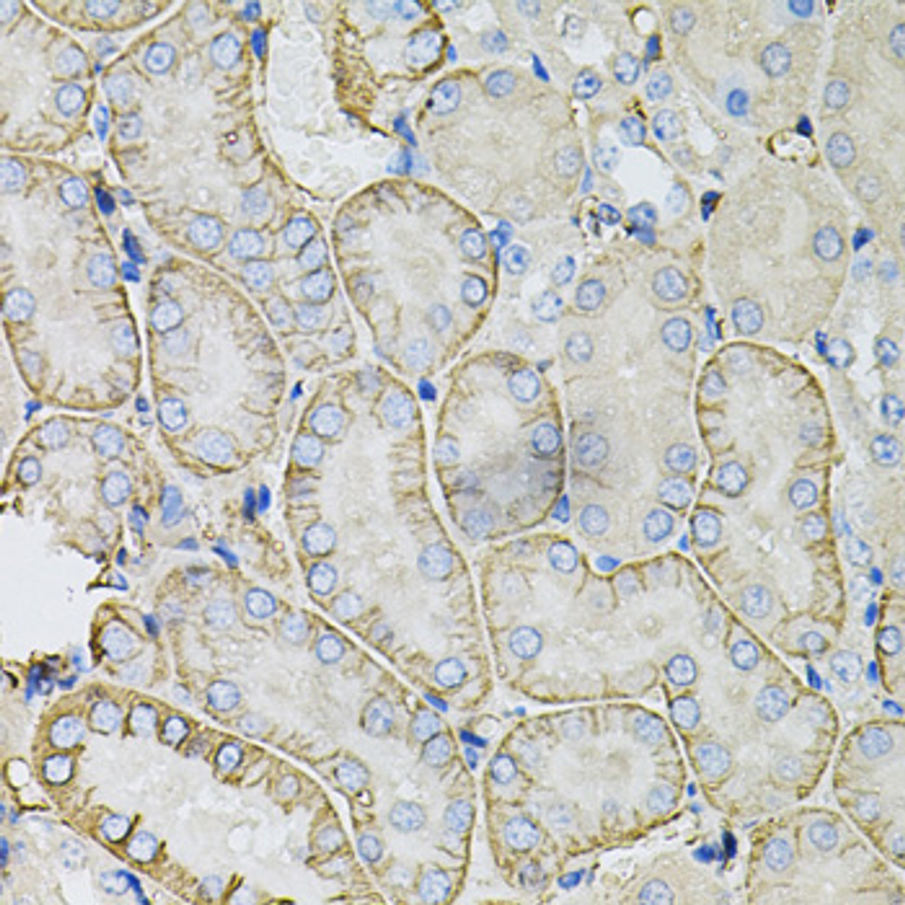 Immunohistochemistry of paraffin-embedded Mouse kidney using SLC4A4 / NBC Polyclonal Antibody at dilution of  1:100 (40x lens).