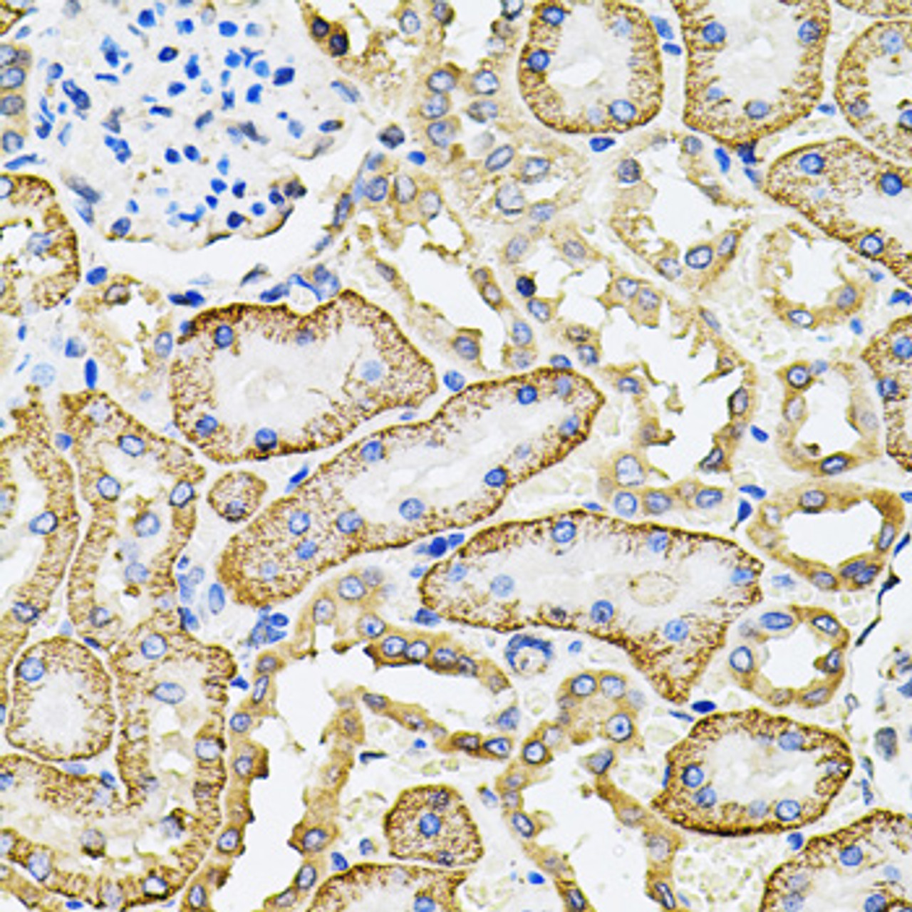 Immunohistochemistry of paraffin-embedded Rat kidney using SLC4A4 / NBC Polyclonal Antibody at dilution of  1:100 (40x lens).