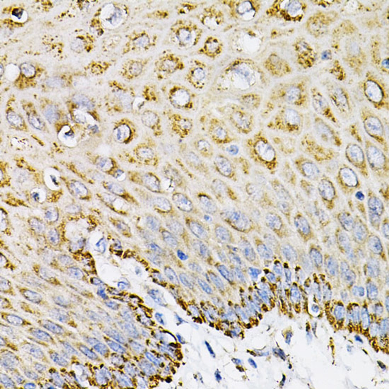 Immunohistochemistry of paraffin-embedded Human esophagus using EFNA1 Polyclonal Antibody at dilution of  1:100 (40x lens).