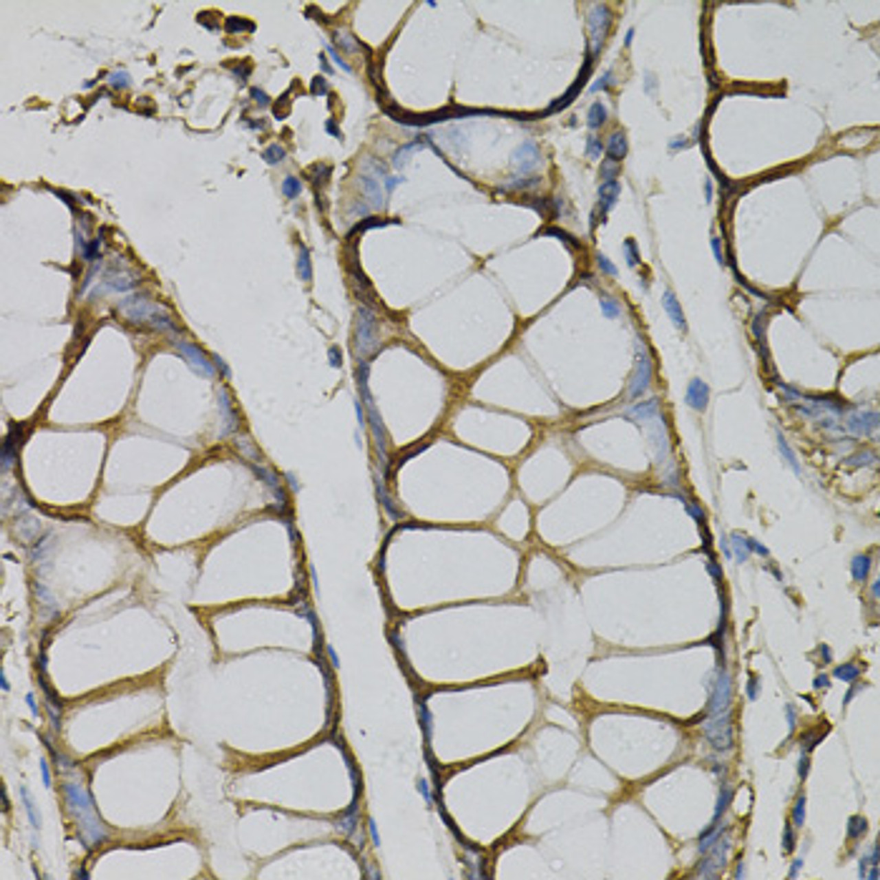 Immunohistochemistry of paraffin-embedded Human colon using AZGP1 Polyclonal Antibody at dilution of  1:100 (40x lens).