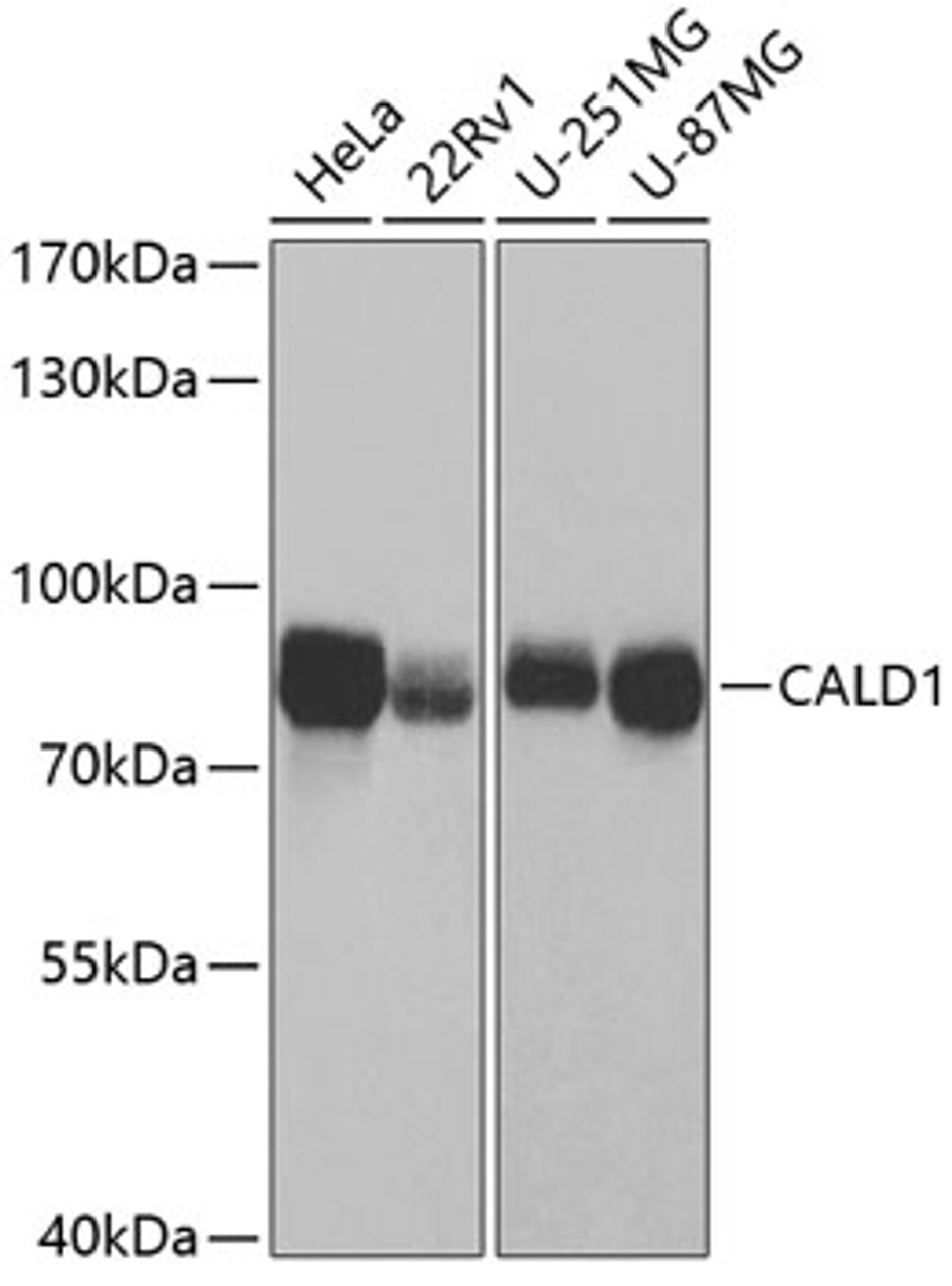 Western blot analysis of extracts of various cell lines using CALD1 Polyclonal Antibody at dilution of 1:1000.