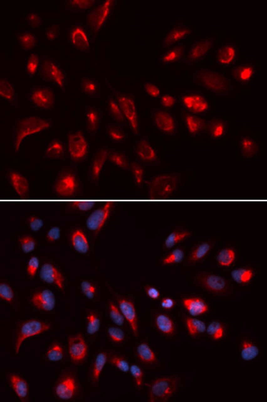 Immunofluorescence analysis of U2OS cells using CHRM5 Polyclonal Antibody