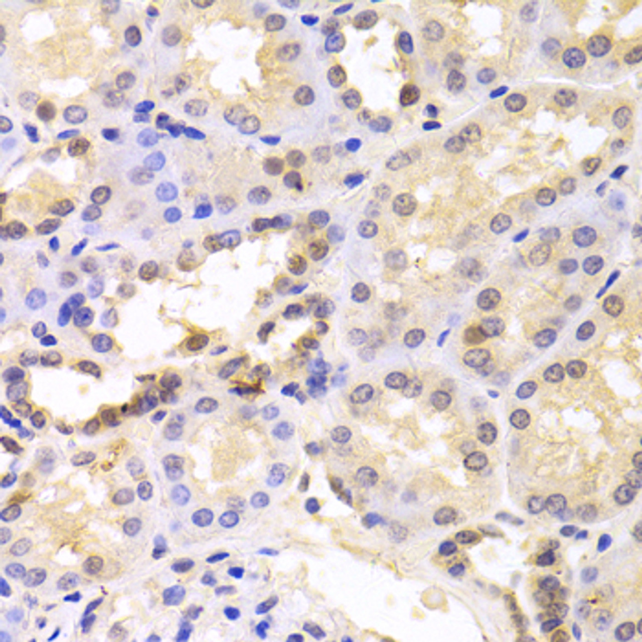Immunohistochemistry of paraffin-embedded Human kidney using PSMC6 Polyclonal Antibody at dilution of  1:100 (40x lens).