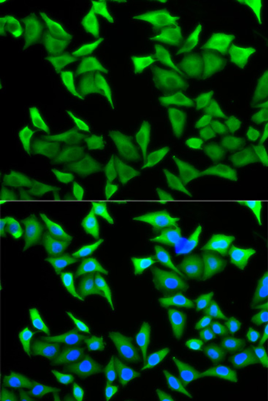 Immunofluorescence analysis of HeLa cells using Nectin 2/CD112 Polyclonal Antibody