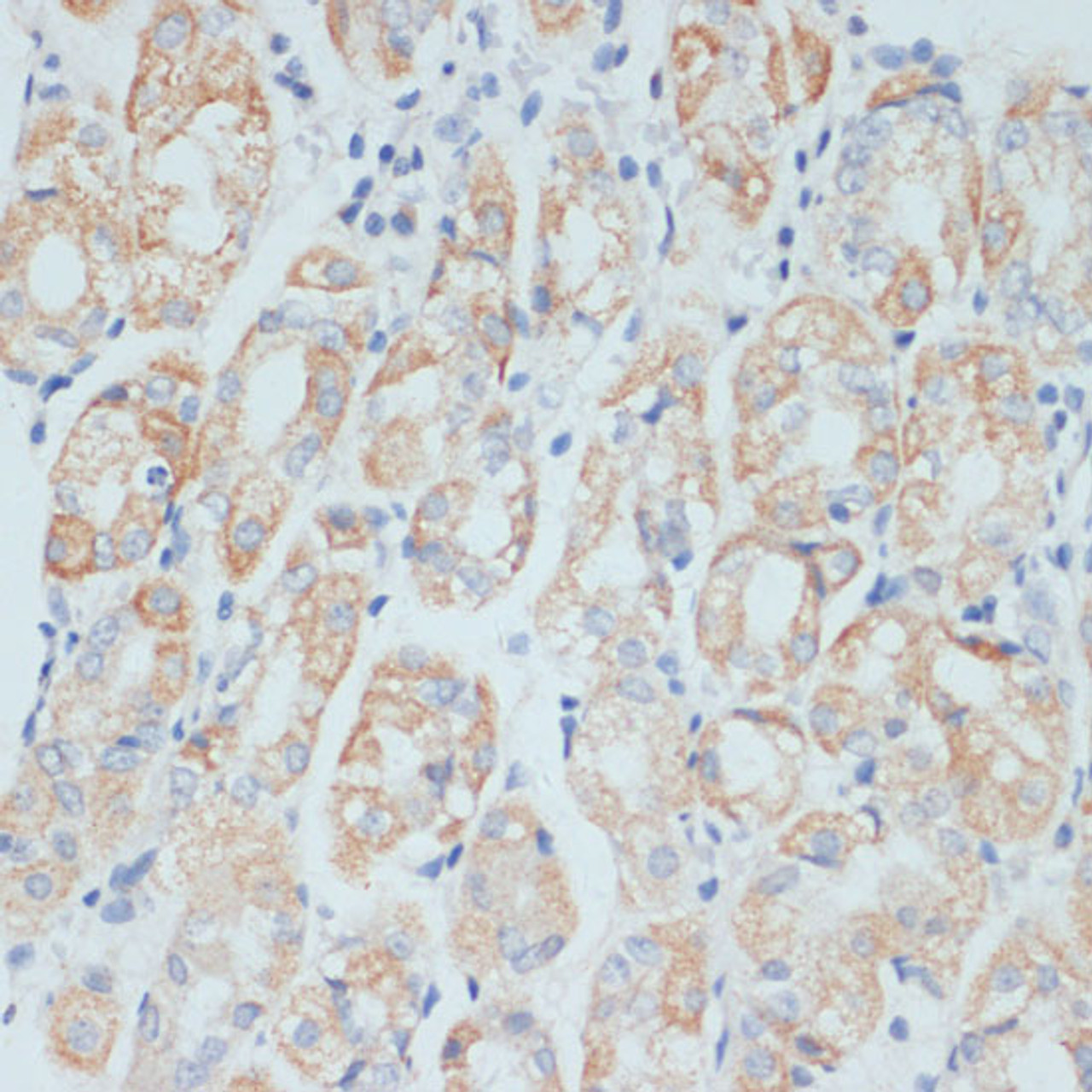 Immunohistochemistry of paraffin-embedded Human stomach using ADAM9 Polyclonal Antibody at dilution of  1:100 (40x lens).