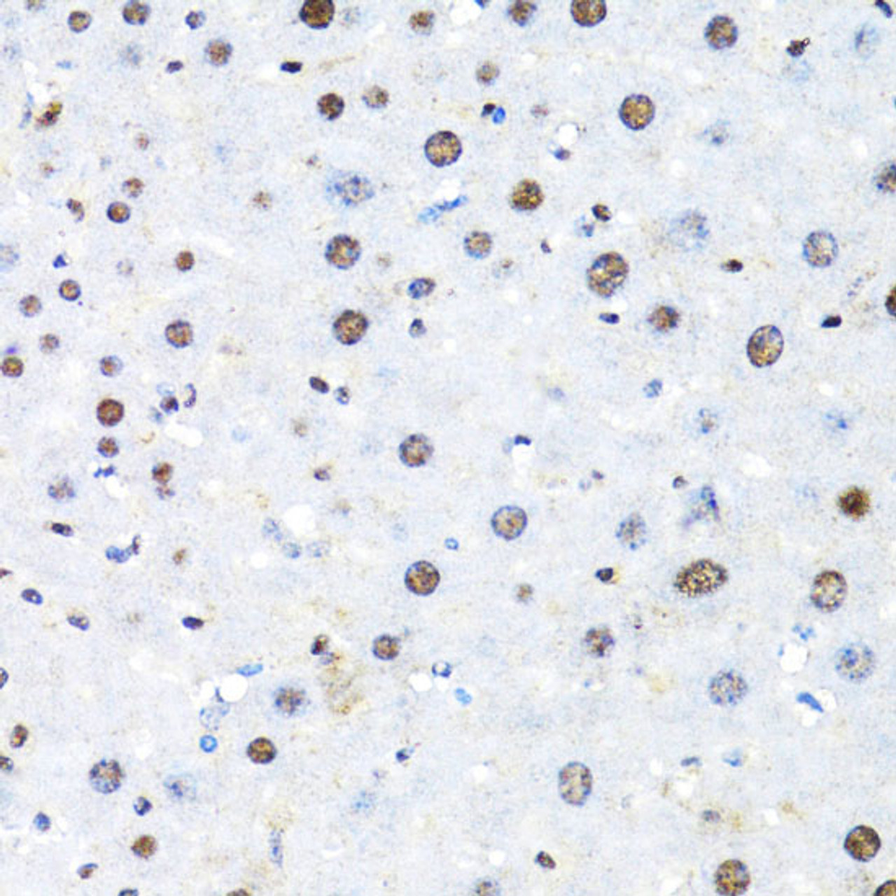 Immunohistochemistry of paraffin-embedded Mouse liver using BACH1 Polyclonal Antibody at dilution of  1:100 (40x lens).