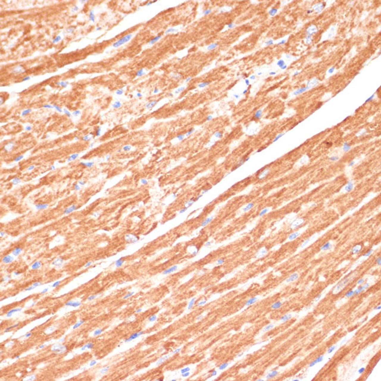 Immunohistochemistry of paraffin-embedded Mouse heart using CYB5A Polyclonal Antibody at dilution of  1:100 (40x lens).