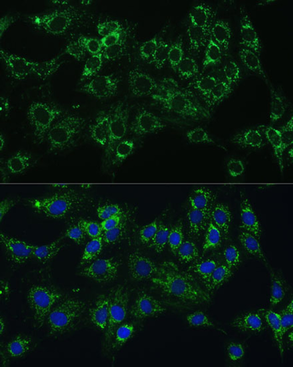 Immunofluorescence analysis of C6 cells using CYB5A Polyclonal Antibody at dilution of  1:100 (40x lens). Blue: DAPI for nuclear staining.