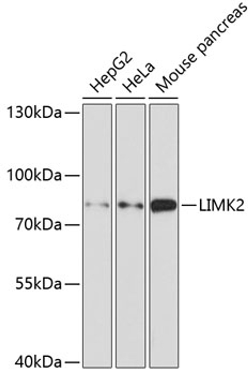 Western blot analysis of extracts of various cell lines using LIMK2 Polyclonal Antibody at dilution of 1:1000.