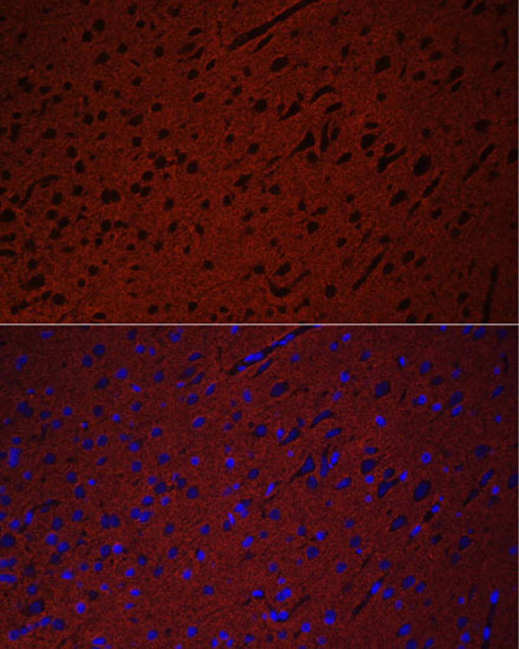 Immunofluorescence analysis of Rat brain using STXBP1 Polyclonal Antibody at dilution of  1:50. Blue: DAPI for nuclear staining.