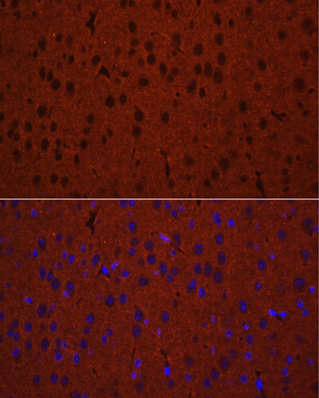 Immunofluorescence analysis of Mouse brain using STXBP1 Polyclonal Antibody at dilution of  1:50. Blue: DAPI for nuclear staining.