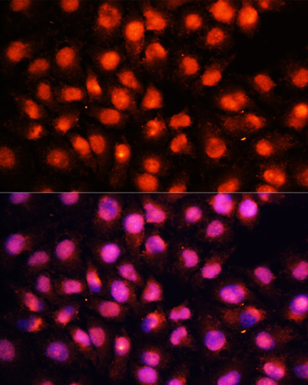 Immunofluorescence analysis of HeLa cells using STXBP1 Polyclonal Antibody at dilution of  1:100 (40x lens). Blue: DAPI for nuclear staining.