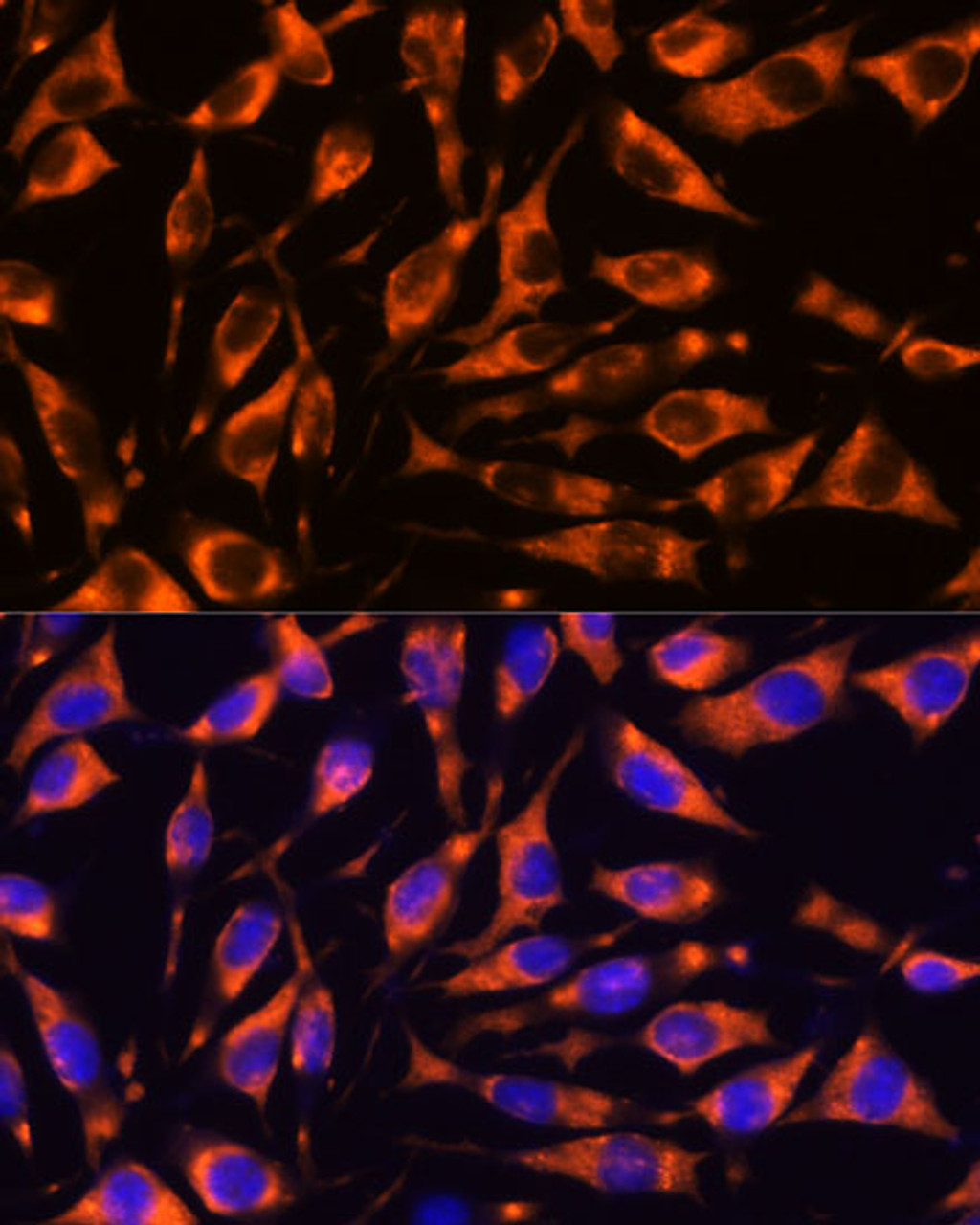 Immunofluorescence analysis of L929 cells using RIP3 Polyclonal Antibody at dilution of  1:100. Blue: DAPI for nuclear staining.