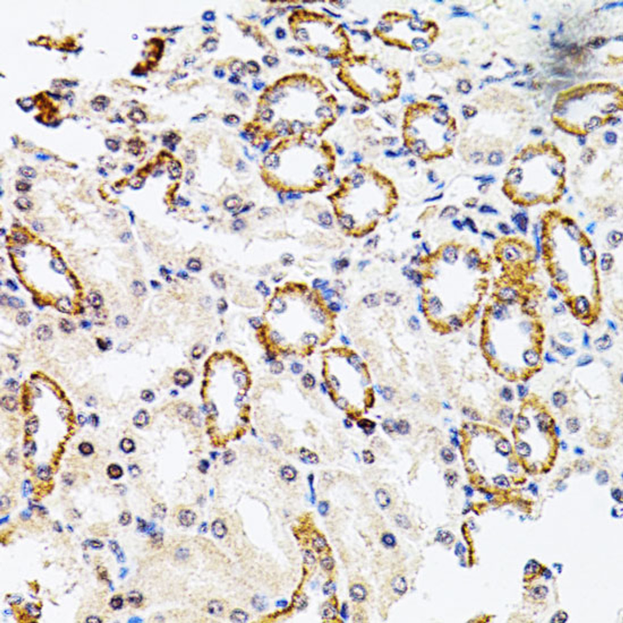 Immunohistochemistry of paraffin-embedded Rat kidney using RPS6KA3 Polyclonal Antibody at dilution of  1:100 (40x lens).