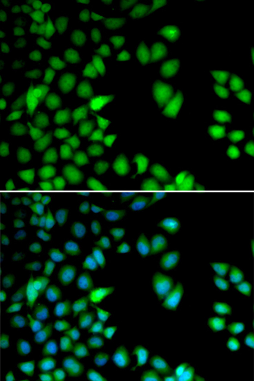 Immunofluorescence analysis of HeLa cells using RPS6KA3 Polyclonal Antibody