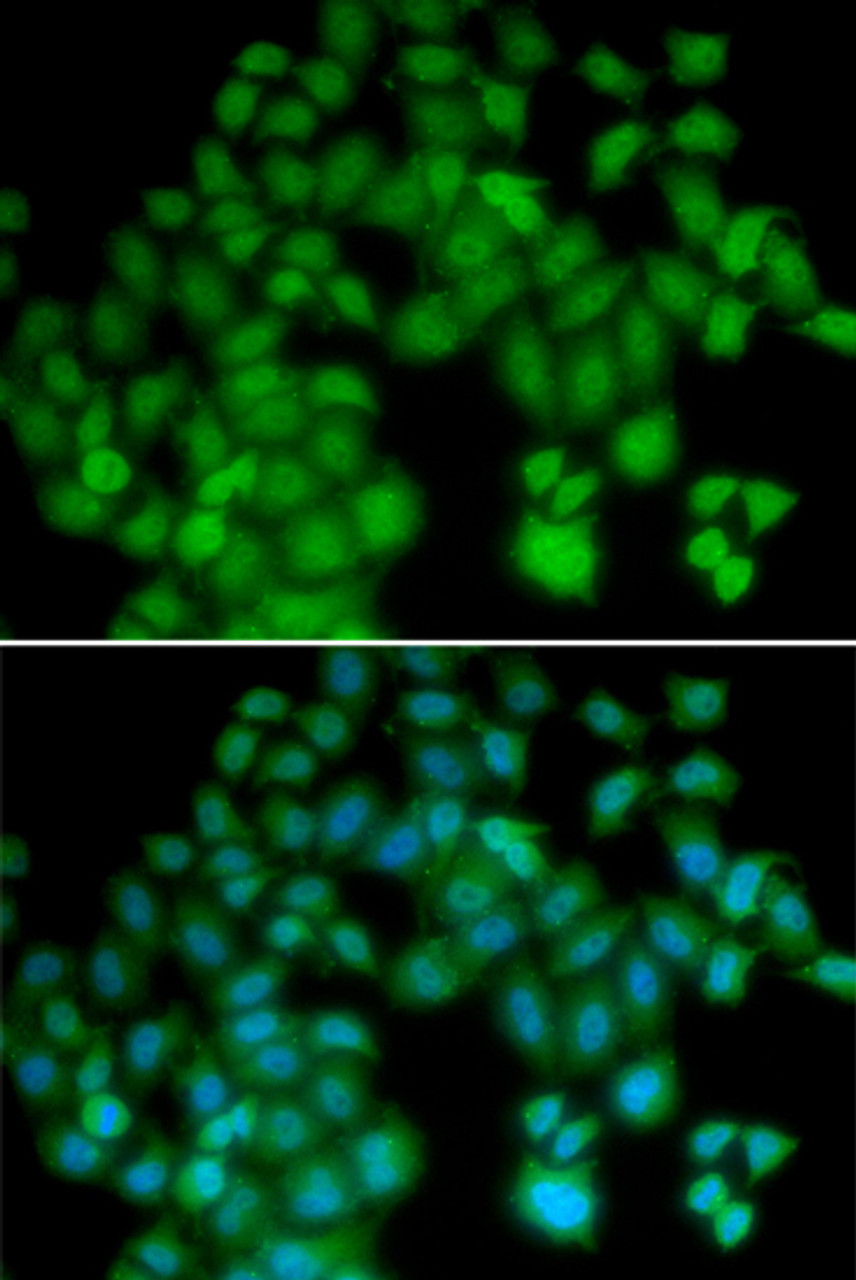 Immunofluorescence analysis of HeLa cells using TMSB4X Polyclonal Antibody