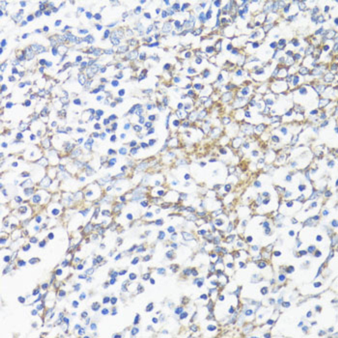 Immunohistochemistry of paraffin-embedded Human tonsil using HSD17B10 Polyclonal Antibody at dilution of  1:100 (40x lens).
