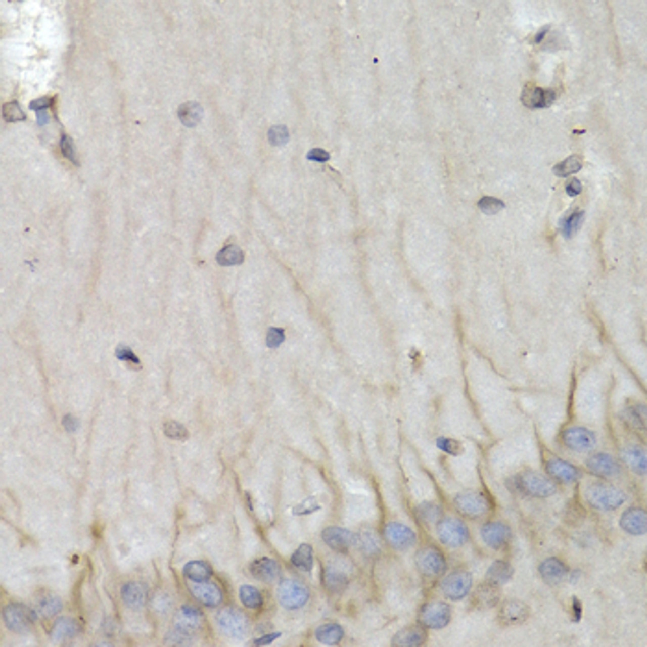 Immunohistochemistry of paraffin-embedded Rat brain using PSMB10 Polyclonal Antibody at dilution of  1:200 (40x lens).