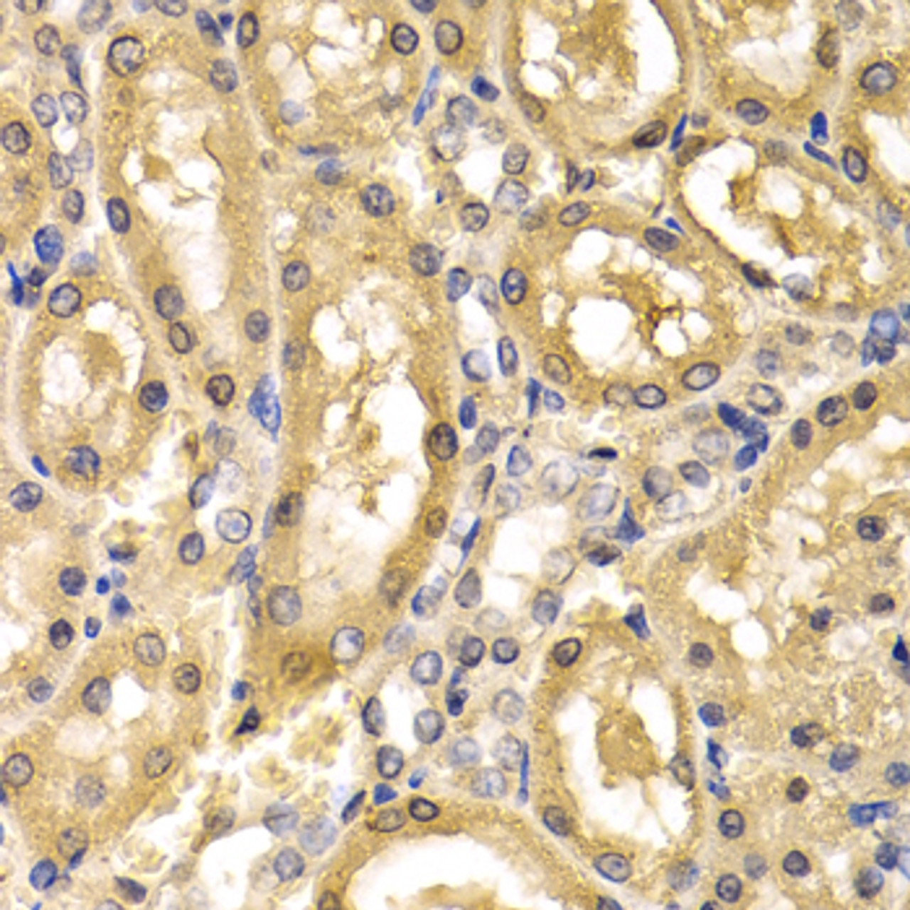 Immunohistochemistry of paraffin-embedded Rat kidney using ADH4 Polyclonal Antibody at dilution of  1:200 (40x lens).