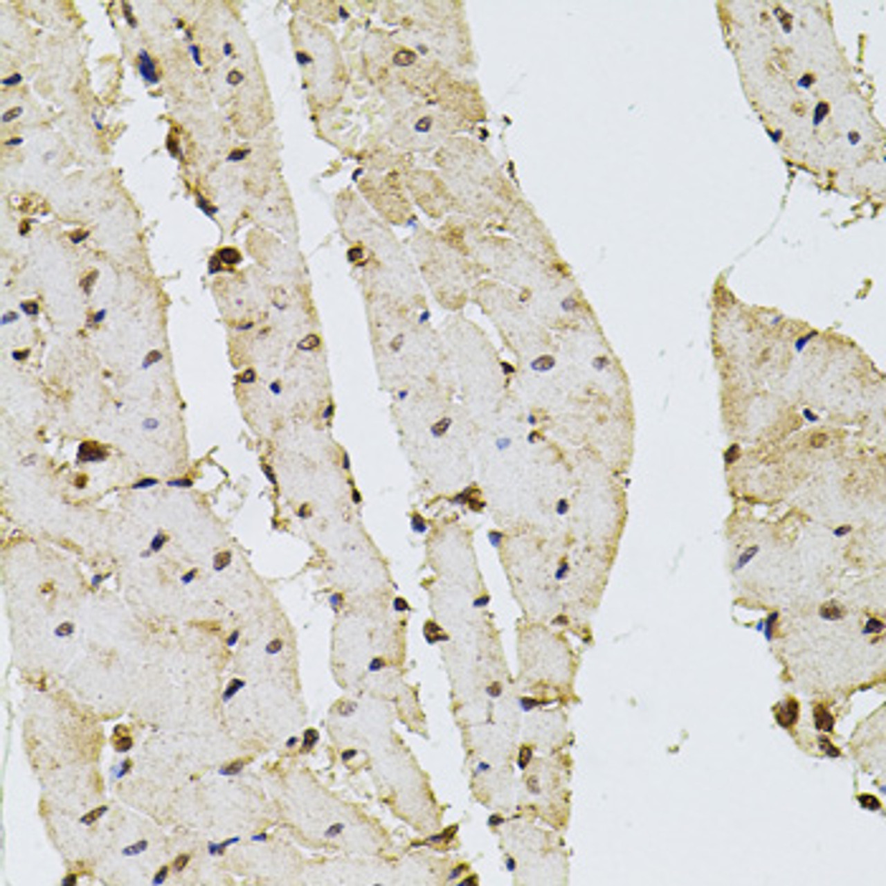 Immunohistochemistry of paraffin-embedded Rat heart using PPP2R5C Polyclonal Antibody at dilution of  1:100 (40x lens).