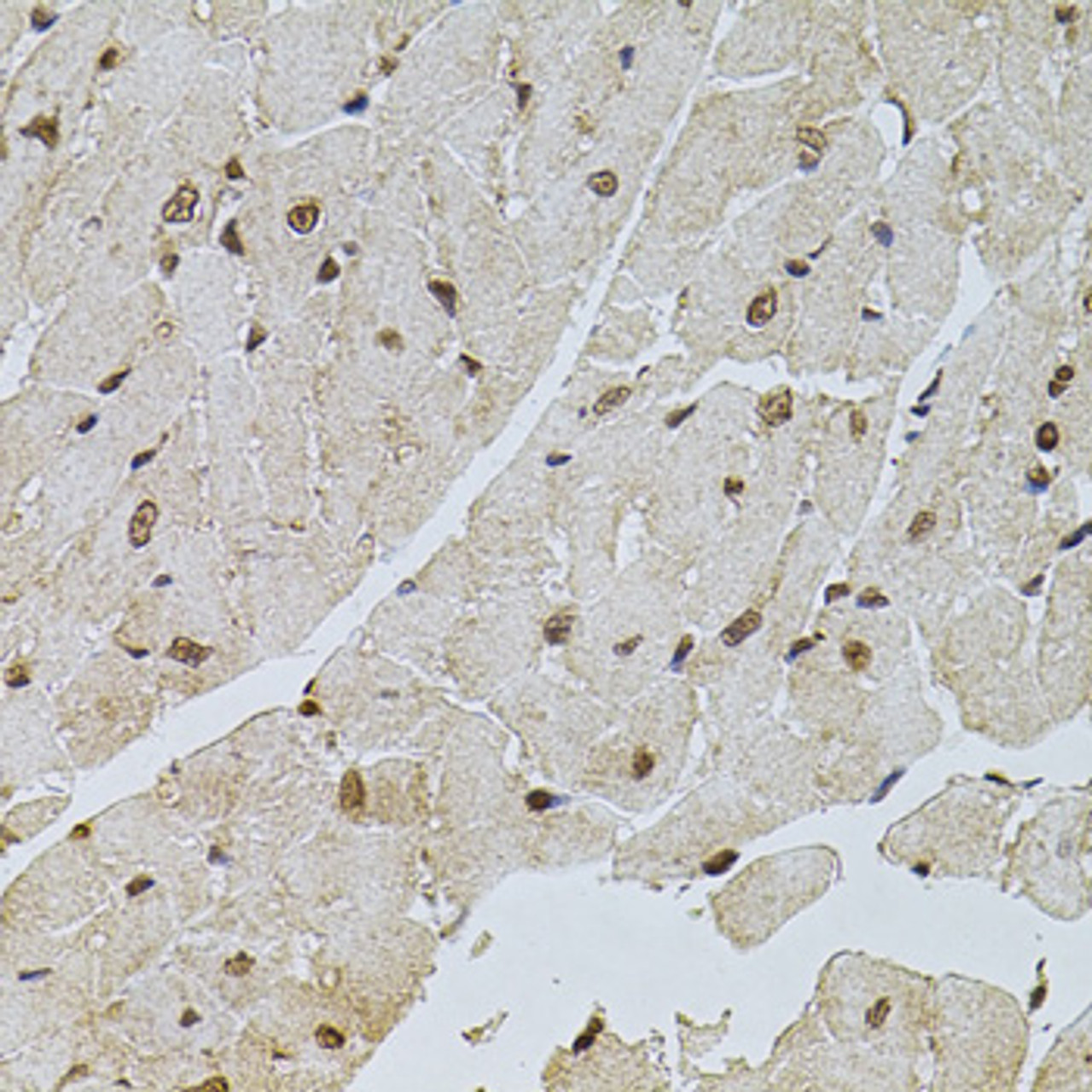 Immunohistochemistry of paraffin-embedded Mouse heart using PPP2R5C Polyclonal Antibody at dilution of  1:100 (40x lens).