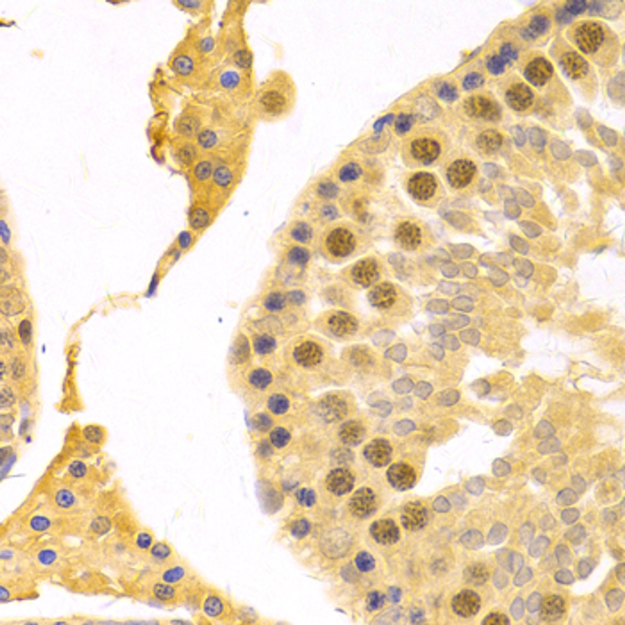 Immunohistochemistry of paraffin-embedded Rat testis using RFC4 Polyclonal Antibody at dilution of  1:100 (40x lens).