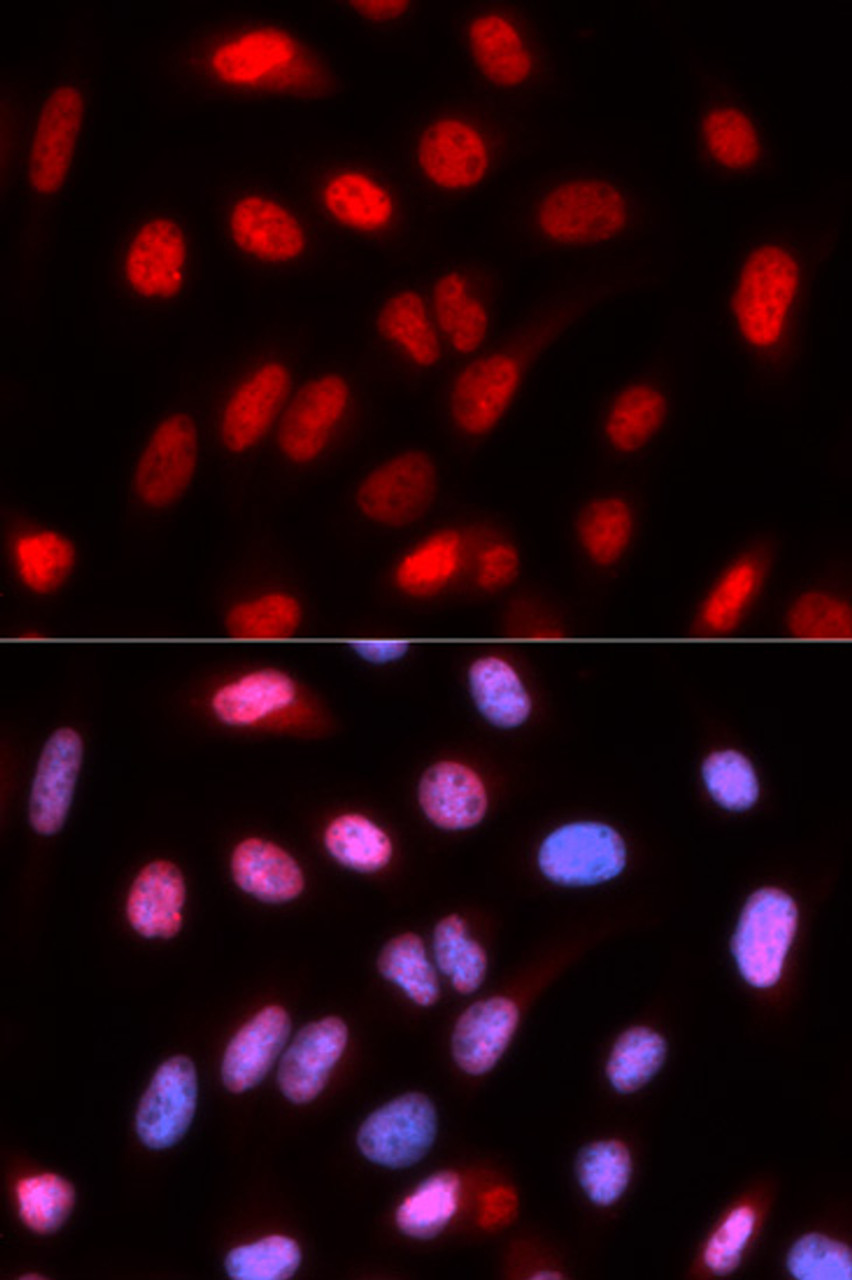 Immunofluorescence analysis of U2OS cells using RFC4 Polyclonal Antibody